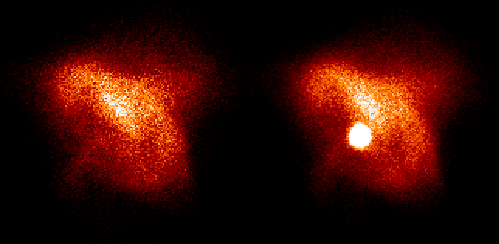 \psfig {figure=crab2.eps,width=11cm,clip=}
